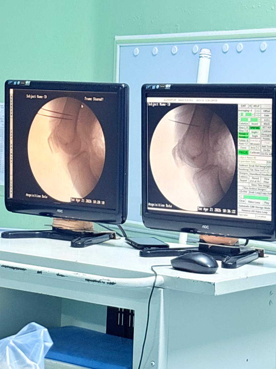 ऑपरेशन के बिना इलाज का कमाल, इन्दिरेश अस्पताल फिर बना अग्रणी